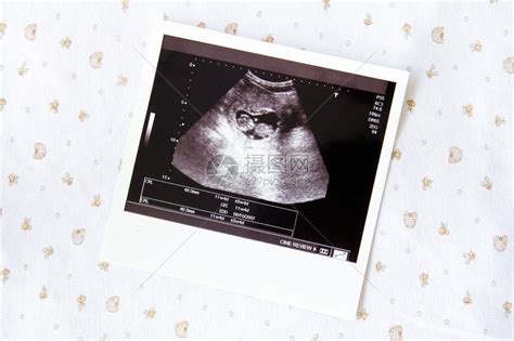 超声波对未出生婴儿高清图片下载-正版图片502936211-摄图网