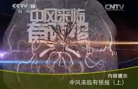 CCTV10健康之路视频20141111天冷要防脑中风1-姜卫剑_健康之路_99养生堂