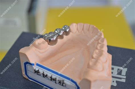 纯钛活动假牙价格:纯钛全口活动义齿6000元+/半口假牙3000元起 - 口腔资讯 - 牙齿矫正网