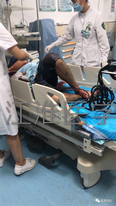 广州2名医生被砍伤，时隔20余天后警方通报来了！_伤医事件_医疗暴力_砍伤医生_医脉通