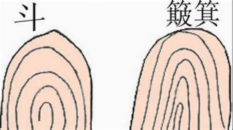 手指的斗和簸箕有何区别？专家做出解释，竟能一眼看穿人的命运！_腾讯视频
