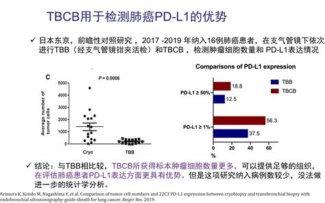 郭述良教授：经支气管冷冻肺活检技术（TBCB）技术在适用范围扩展、优势比较、技术要点方面有何更新？丨CACP 2020-学术-呼吸界