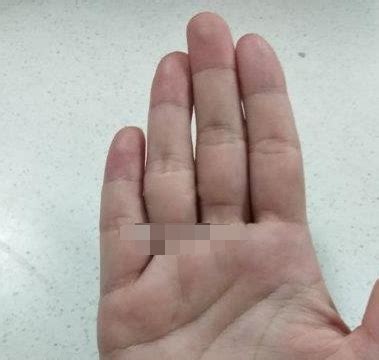 腾蛇入口面相图片