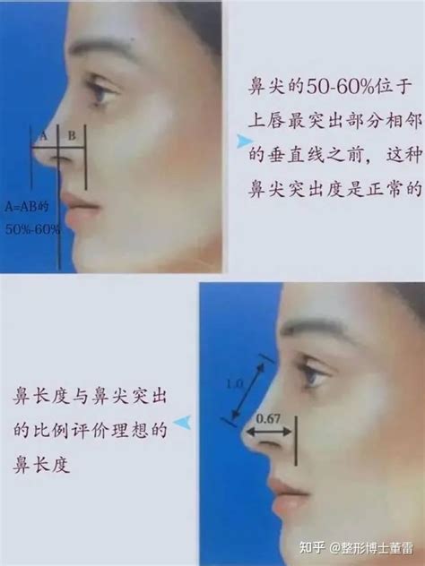 四大常见的鼻尖整形方法都有哪些？ - 知乎