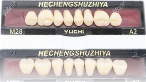 塑钢牙的价格是多少?做一颗/全口塑钢牙义齿的价格公布,牙齿修复-8682赴韩整形网