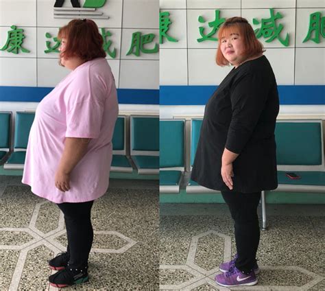 女孩减肥剩50斤样貌变化巨大令人不忍直视 女生要怎么正确减肥_社会新闻_海峡网