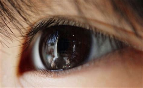 孩子眼睛总流泪,小心这些眼部疾病作祟__重庆眼视光眼科医院