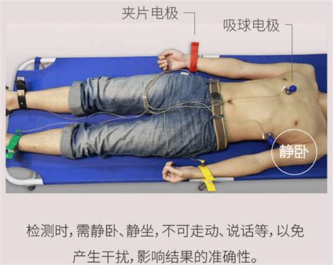 心电图连接示意图图片