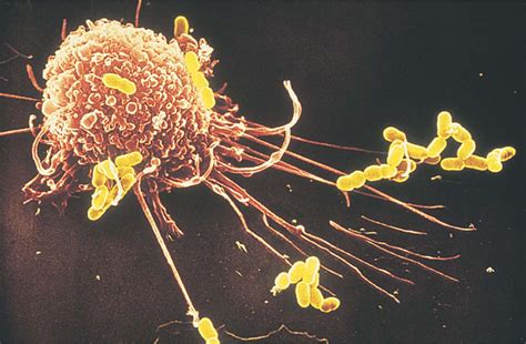 科学网—我们不知道答案的125个科学问题(22)艾滋病毒的疫苗 - 张林的博文