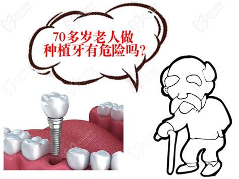 老年人全口无牙能做种植牙吗——广州德伦口腔