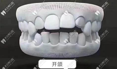 牙科材料 牙挺 不锈钢牙挺 直挺 弯挺 牙科齿科口腔 器械-阿里巴巴