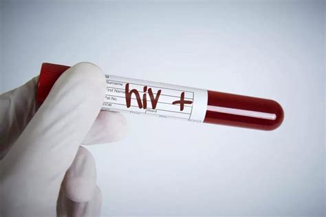艾滋病传染概率是多少_艾滋病传播途径_艾滋病咨询检测网