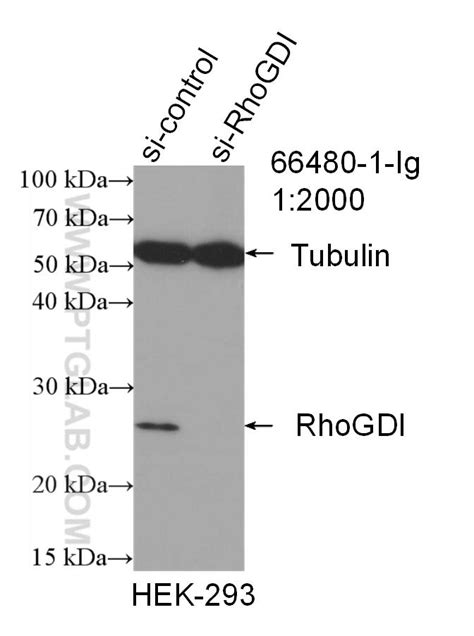 RhoGDI Antibody 66480-1-Ig | Proteintech