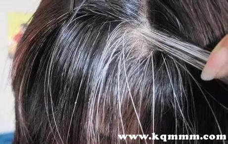 叶酸的作用与功效白发变黑发，叶酸能防止白发吗 - 海淘族