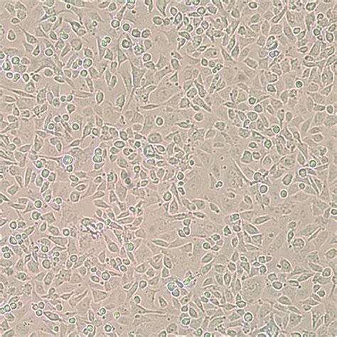 ING1基因沉默后通过抑制Caspase 2调节胃腺癌AGS细胞凋亡