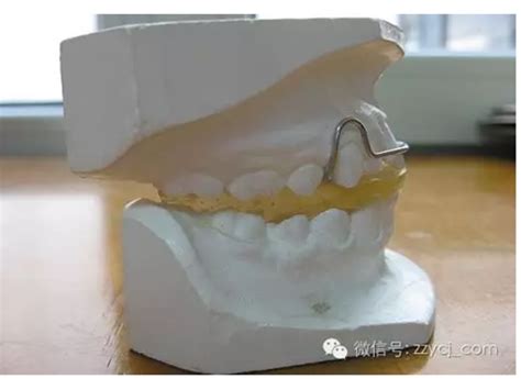 肌激动器图片