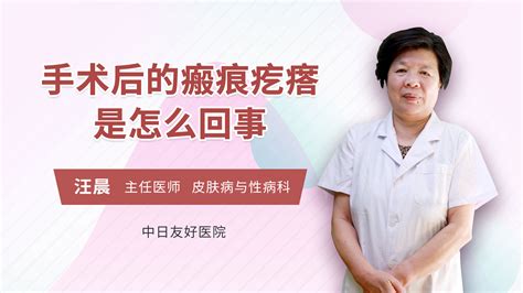 孕妇得了湿疹该怎么办_汪晨医生视频讲解皮肤科疾病-快速问医生