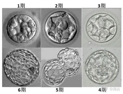 试管科普｜什么是优质胚胎，试管婴儿的胚胎分级你必须知道 - 知乎