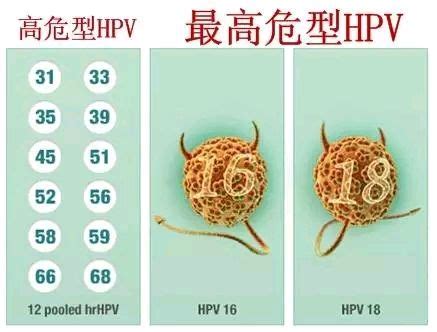 关于宫颈癌预防，关于HPV疫苗_蒋佩茹医生_新浪博客