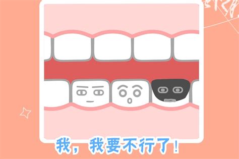 在线解答 | 牙齿龋坏到什么程度，才需要做根管治疗？ - 知乎