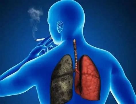 戒烟后，人的肺多久能恢复正常？ - 知乎