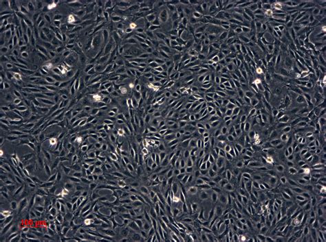SV40 MES 13细胞ATCC CRL-1927细胞 SV40MES13小鼠肾小球系膜细胞株购买价格、培养基、培养条件、细胞图片、特征等 ...