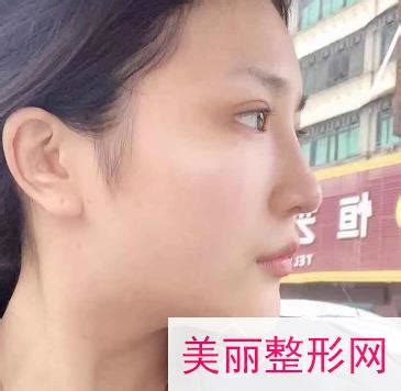 北京八大处2020价目表公示，含张智勇做下颌角三个月恢复经历_美嘉整形网(美学知识)