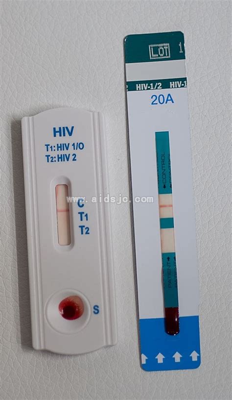 艾滋病检测多久出结果_艾滋病检测_艾测网