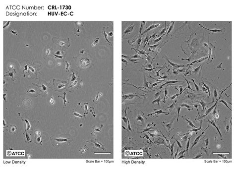HUV-EC-C细胞ATCC CRL-1730细胞 HUVECC人脐静脉内皮细胞株购买价格、培养基、培养条件、细胞图片、特征等基本信息_生物风