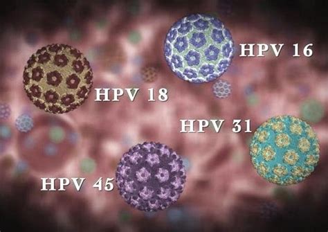 感染了HPV都会得宫颈癌？看完这些分析，发现预防HPV并不难_凤凰网