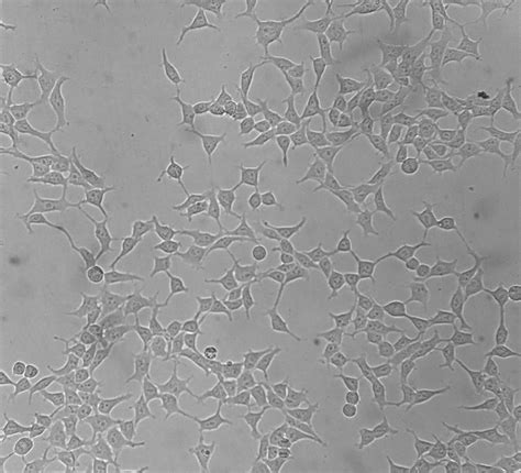 细胞形态异常剖析 Step1 - 技术前沿 - 生物在线 Lab-on-Web