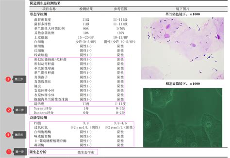 女孩阴道图片