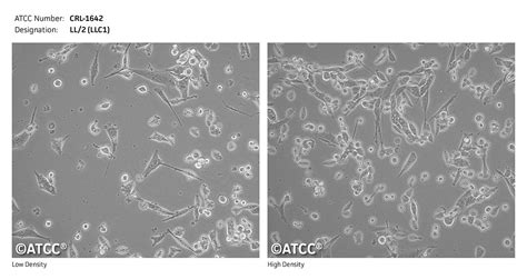 LL/2 (LLC1)细胞ATCC CRL-1642细胞 LL2LLC1小鼠肺癌细胞株购买价格、培养基、培养条件、细胞图片、特征等基本信息_生物风