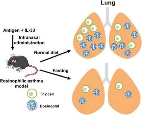 Fasting impairs type 2 helper T cell infiltration in the lung of an ...