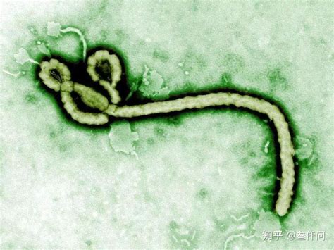 埃博拉病毒为什么突然消失（史上最强病毒埃博拉的来历） | 刀哥爱八卦