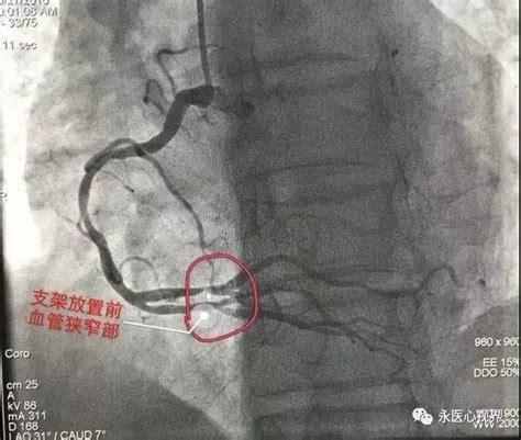 竹溪县人民医院关于投诉渠道的通知 - 竹溪县人民医院官网