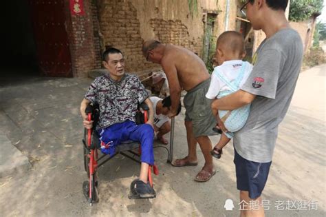 洛阳伊川县农村小兄妹严重烧伤，10岁的哥哥要取皮救妹-大河新闻