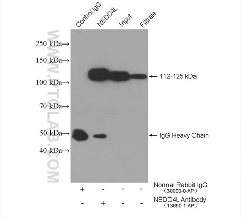 NEDD4L Antibody 13690-1-AP | Proteintech