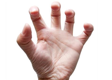 手指关节疼痛难忍？原因多是这四种，对症治疗可以改善-12健康