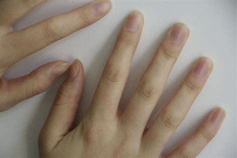 手指肿胀是怎么回事怎么治（醒来后，手指肿胀得厉害，却又找不到原因，是怎么回事？） | 说明书网