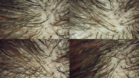 用于对头皮毛和皮肤进行显微镜检查高清图片下载-正版图片506613990-摄图网