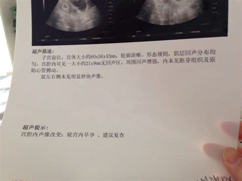 请问怀孕6周了，第一次b超，未见胚芽组织及原始心管搏动 正常吗？感谢回答 - 百度宝宝知道