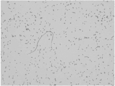 流感嗜血杆菌 BNCCBNCC337544 微生物菌种|北纳生物