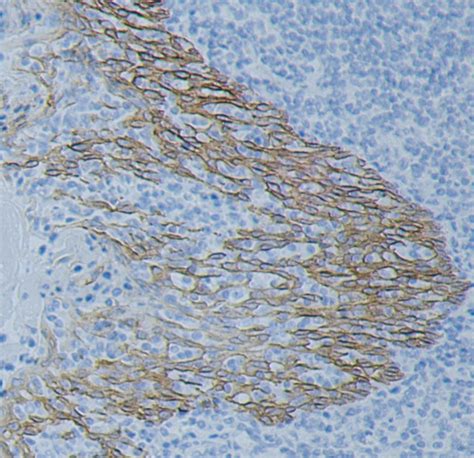 细胞角蛋白8单克隆抗体-上海雅吉生物科技有限公司
