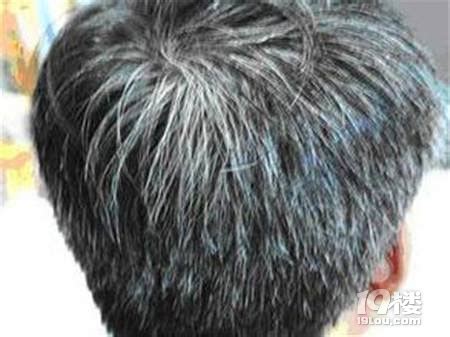 高额头发质细头发还少的男生该理什么发型？|额头|发型|头发_新浪新闻