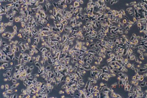 NCI-H292细胞ATCC CRL-1848细胞 H292人肺癌细胞（淋巴结转移）株购买价格、培养基、培养条件、细胞图片、特征等基本信息_生物风