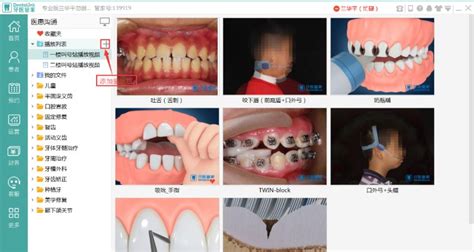 嘉悦口腔口腔扫描系统|UI|软件界面|xcmpeter - 原创作品 - 站酷 (ZCOOL)