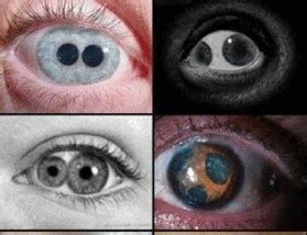 【双瞳孔】【图】双瞳孔是什么原因造成的 细数历史上重瞳的人物(2)_伊秀健康|yxlady.com