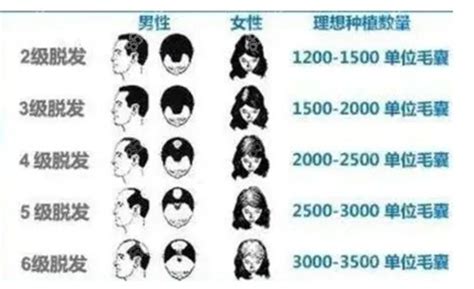 怎么选择适合自己的刘海 头发长度、密度和宽度3大因素才是关键_刘海发型 - 美发站