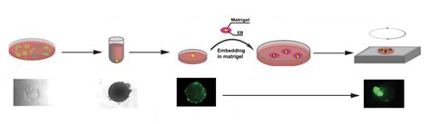 NCX1通过介导钙离子内流损伤足细胞的机制研究